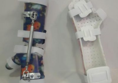 Custom made ορθοπαιδικές κατασκευές