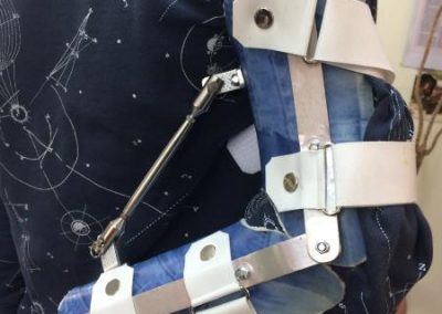 Custom made ορθοπαιδικές κατασκευές