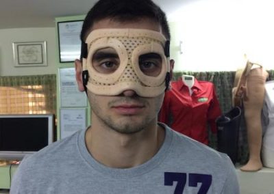 Custom made ορθοπαιδικές κατασκευές