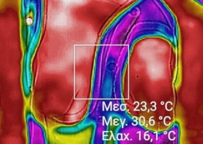 Ψηφιακές Μετρήσεις μέσω Scanner