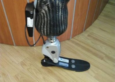 Προσθέσεις Κνήμης